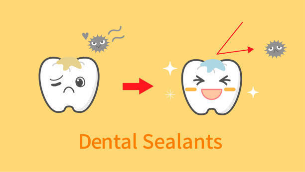 images of teeth for dental sealants program